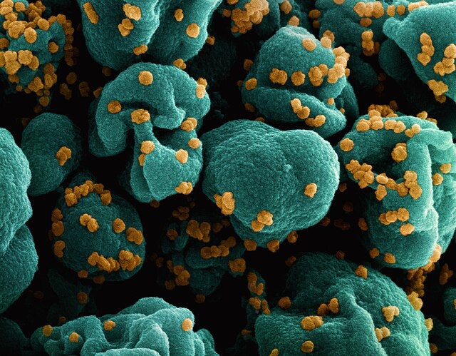 Colorized_scanning_electron_micrograph_of_a_cell_teal_infected_with_SARS-CoV-2_virus